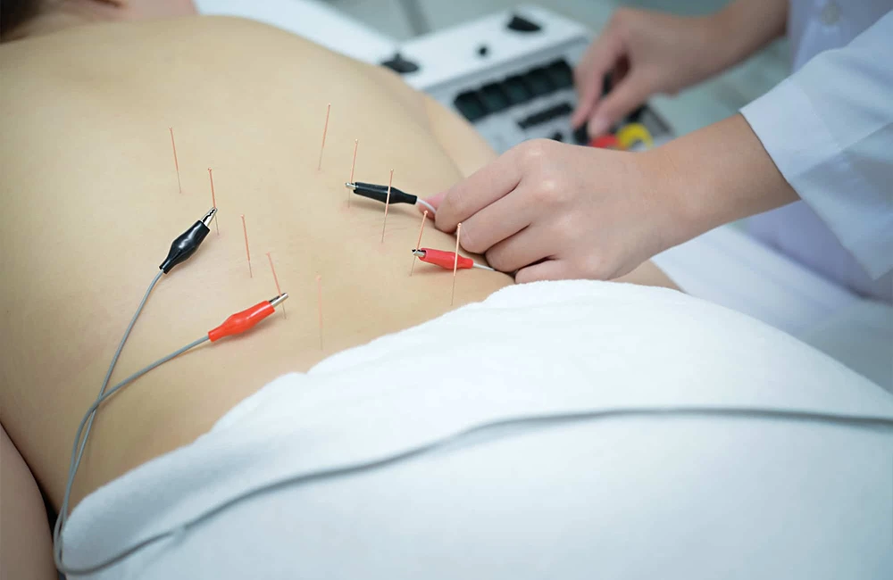 Natural Healing and Acupuncture Treatment Centre Gallery - Image 5