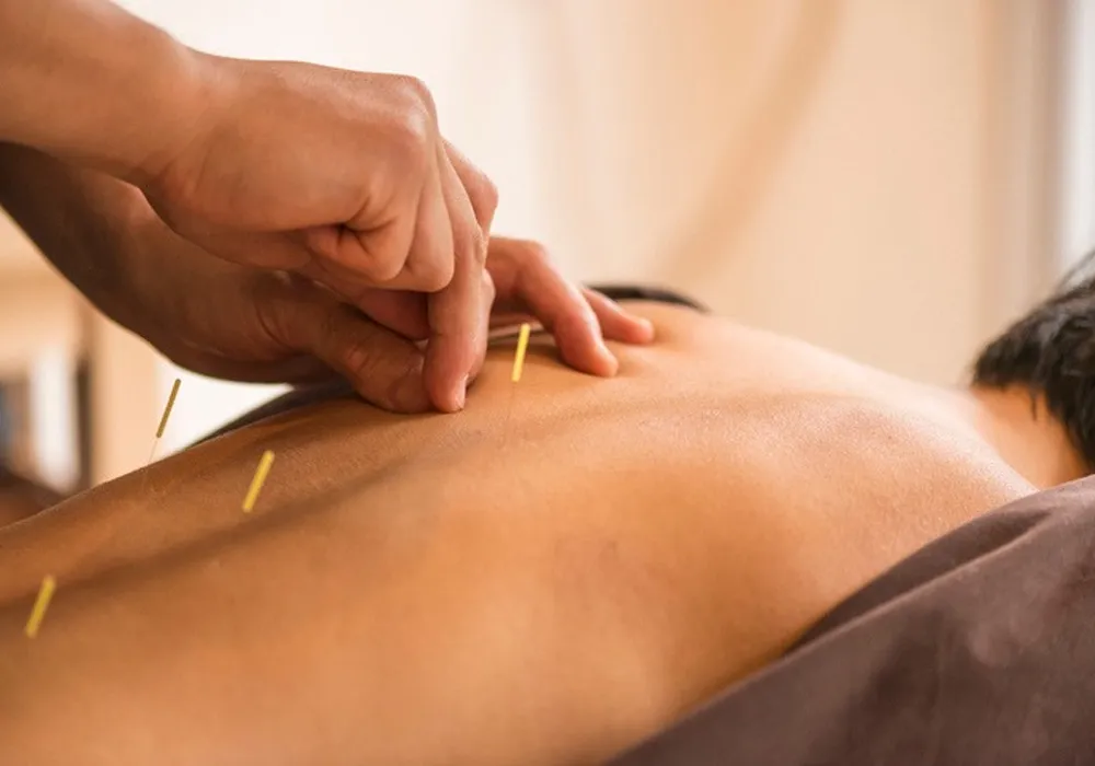 Best Acupuncture Wellness Centre in CIT Nagar, Nandanam for Holistic Healing