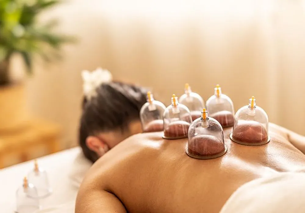 Best Cupping Therapy Clinic in CIT Nagar for Pain Relief and Wellness