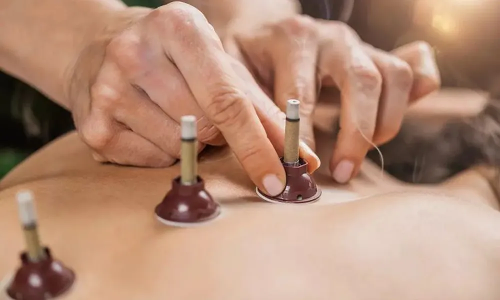 Expert Moxibustion Therapy Service for Natural Pain Relief in CIT Nagar, Nandanam